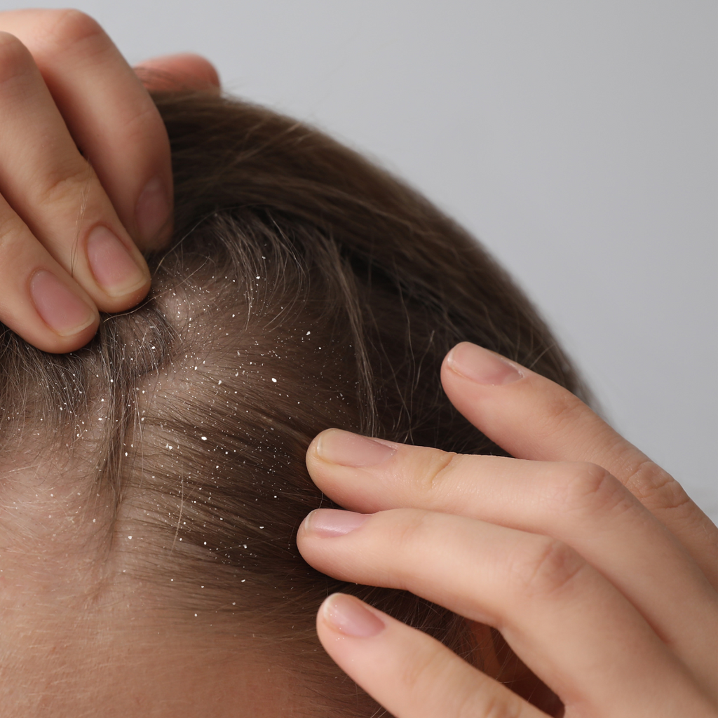 You're a human. You have a flaky scalp. Now what?